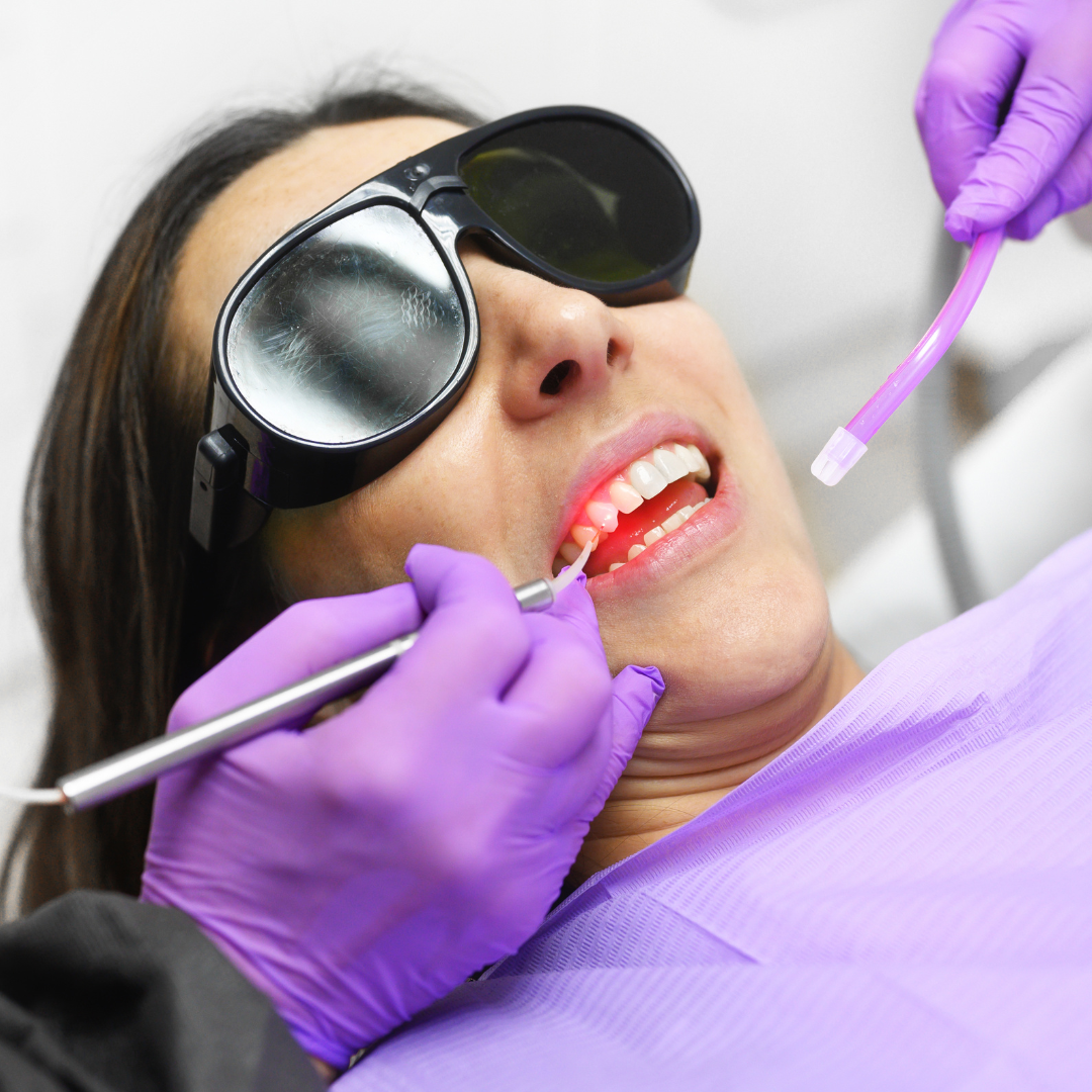 Laser Treatments