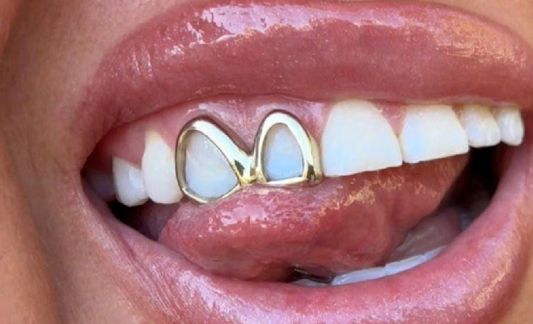 Teeth Whitening